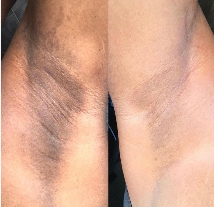 Depoimento de Renata Siqueira sobre o Método Lumina Rosa